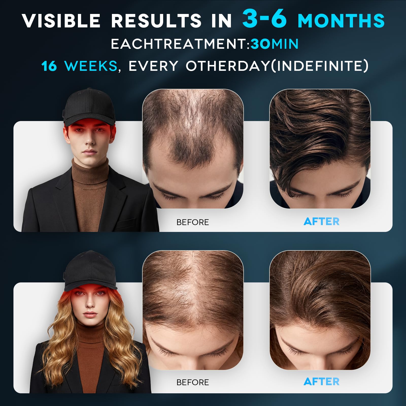 Mroace Wireless Rechargeable Hair Regrowth Laser Cap