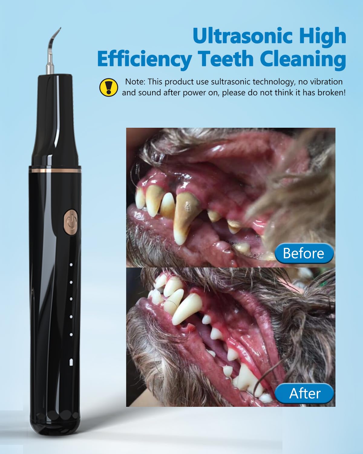 Mroace Plaque Remover for Teeth