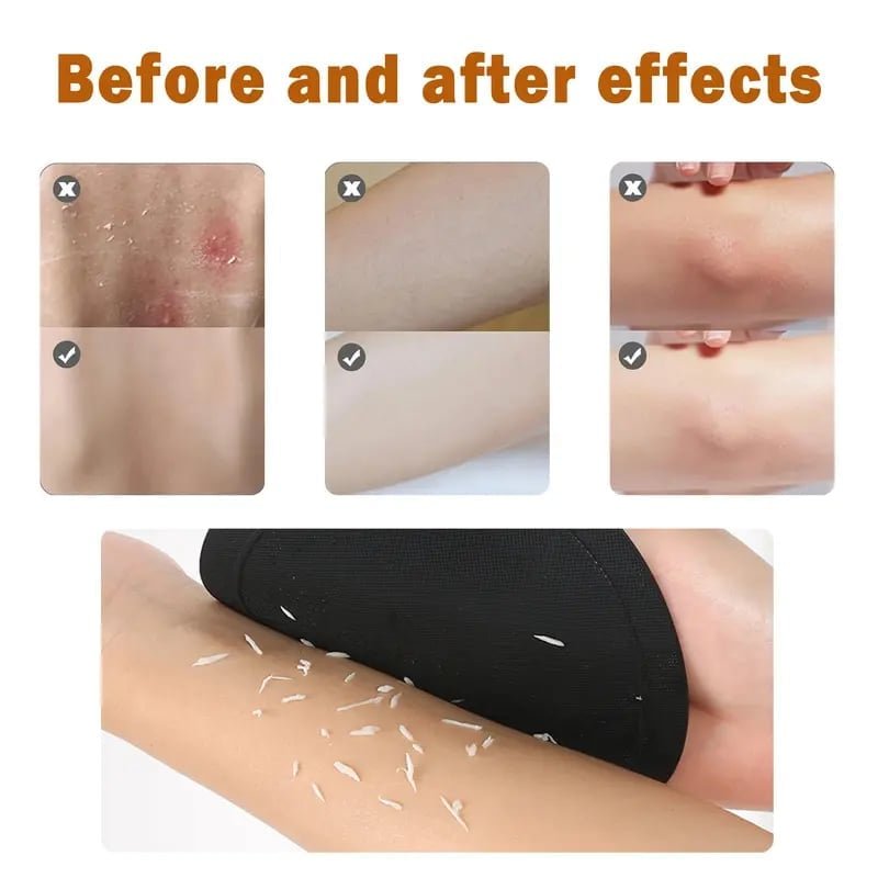 Mroace Premium Exfoliating Body Gloves